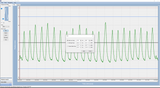 QUASAR™ MRI⁴ᴰ Motion Phantom