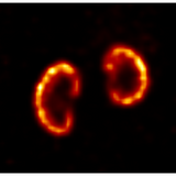 γ-CUBE high-sensitivity, high-resolution SPECT imager