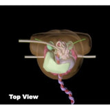 Newborn Torso Phantom