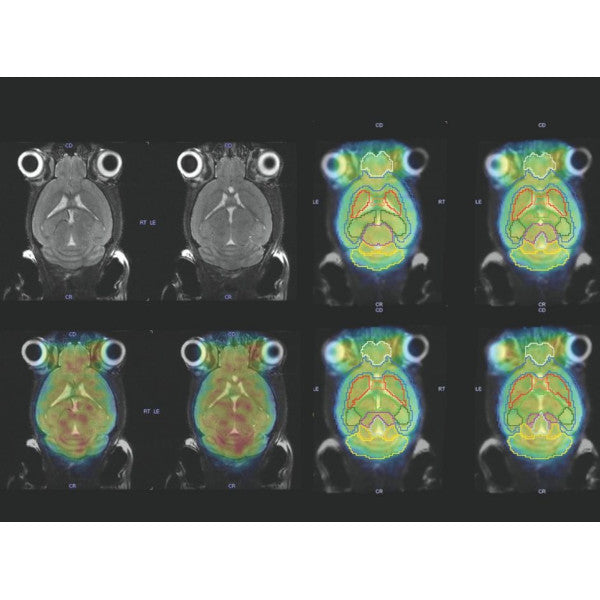 Simultaneous PET/MR – Gamma Gurus